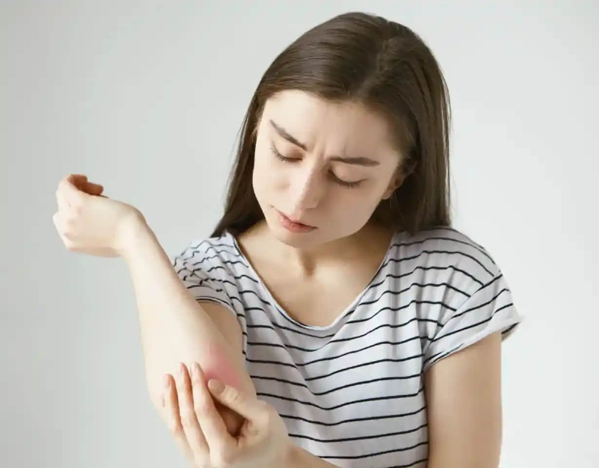 Ciltte Yanık Gibi Kızarıklık Nedenleri Belirtileri ve Etkili Çözüm Yolları