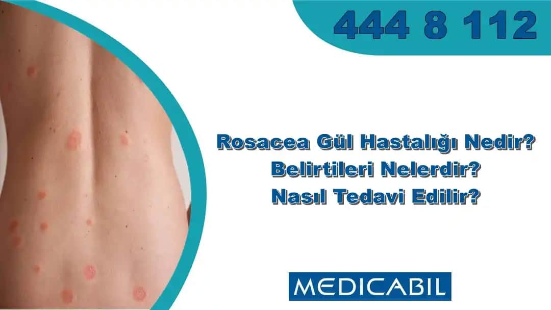 Çocuklarda Gül Hastalığı: Belirtileri, Kozmetik ve Cilt Bakımı İpuçları