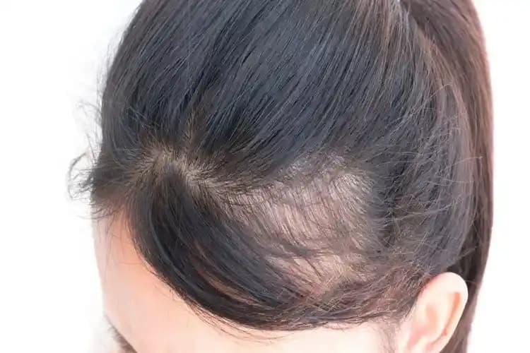 Deniz Suyu ve Saç Uzaması: Minerallerin Saç Sağlığına Etkileri ve Doğru Kullanım Yöntemleri