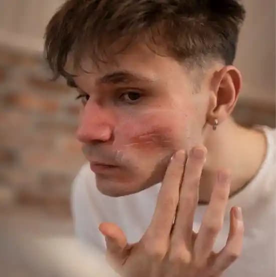 Deri Alerjisi ve Cilt Tahrişi: Kozmetik Ürünlerde Dikkat Edilmesi Gerekenler