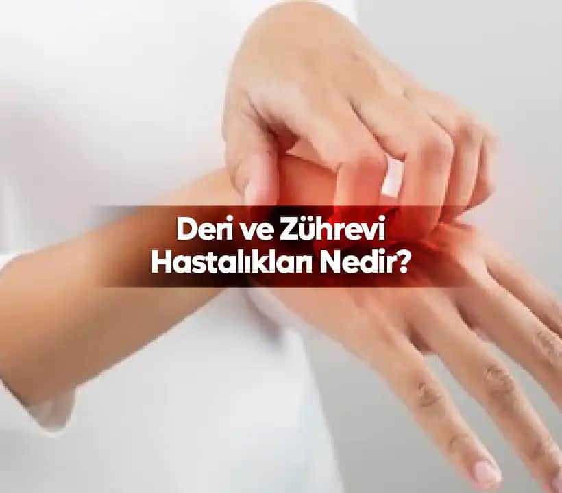 Deri Gribi Nedir, Belirtileri ve Kozmetik Bakımda Önemi Hakkında Bilgiler
