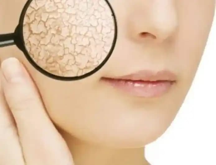 Deri Hassasiyetinin Nedenleri ve Etkili Bakım Yöntemleri Nelerdir