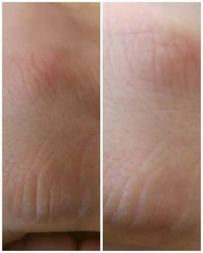 Deri Kararması Nedenleri, Çözümleri ve Bakım İpuçları Hakkında Detaylı Bilgi