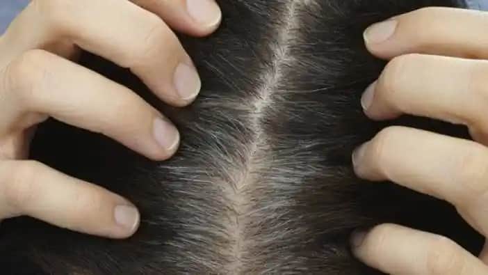 Deri Kaşıntısına Karşı Kozmetik ve Doğal Çözümlerle Rahatlama Rehberi