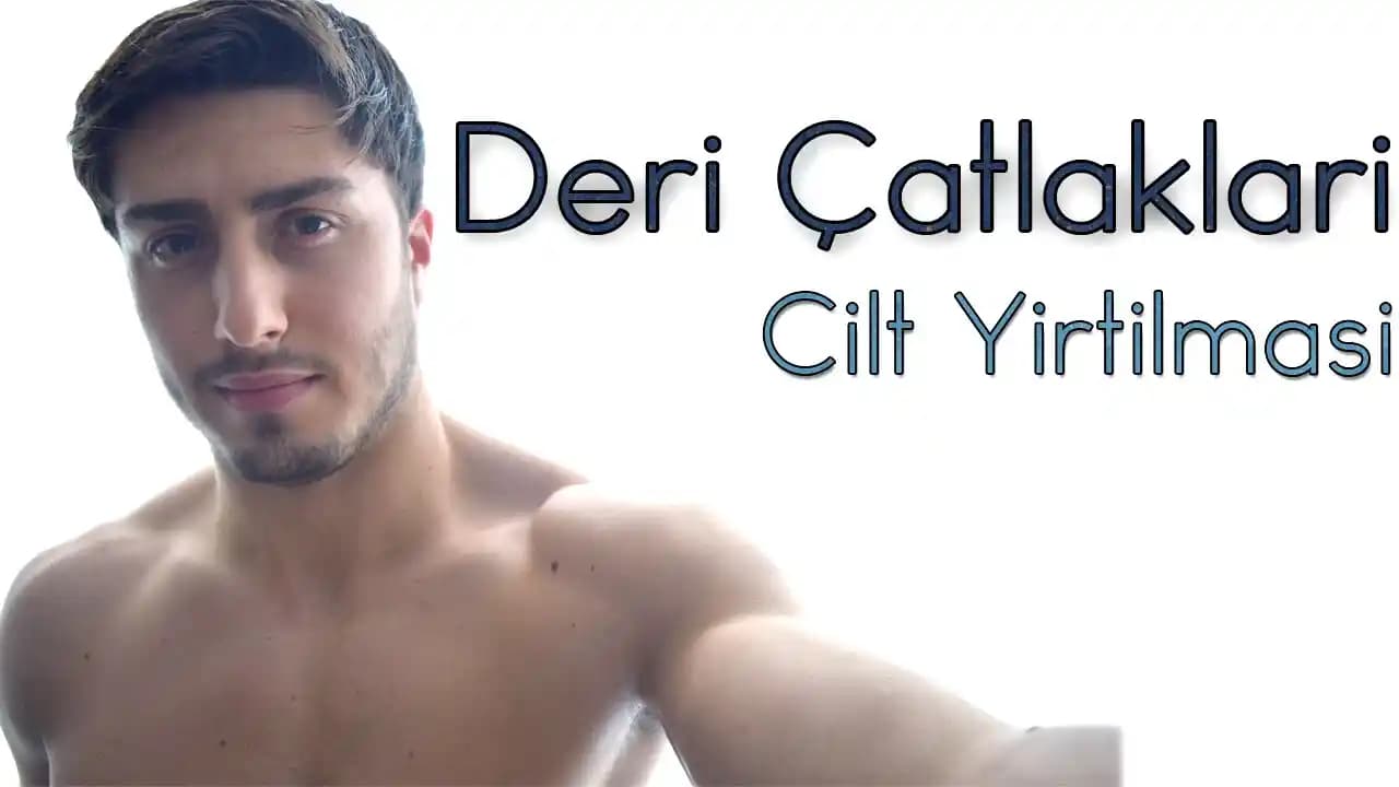 Deri Yırtıklarını Doğal Yollarla Tedavi Etme ve Cilt Sağlığını Koruma Rehberi