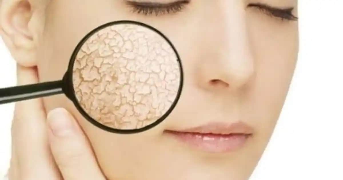 Derinin Pul Pul Dökülmesi Nedenleri, Belirtileri ve Etkili Çözüm Yolları