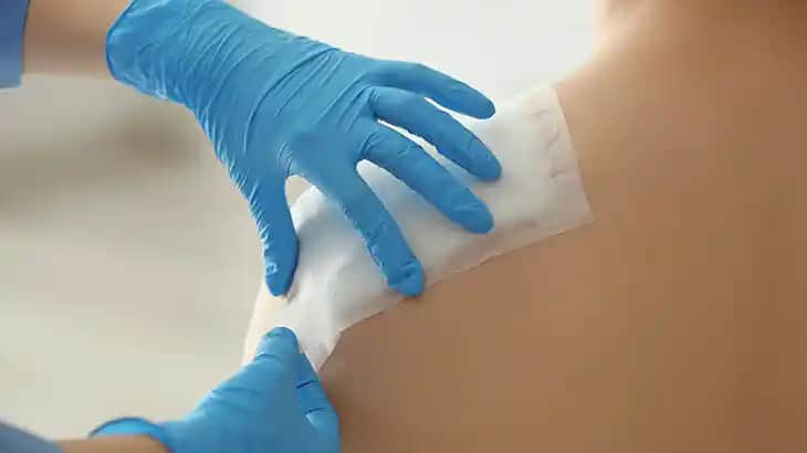 Dikişlerin Kaşınması Nedenleri ve Sağlıklı İyileşme İçin Alınması Gereken Önlemler