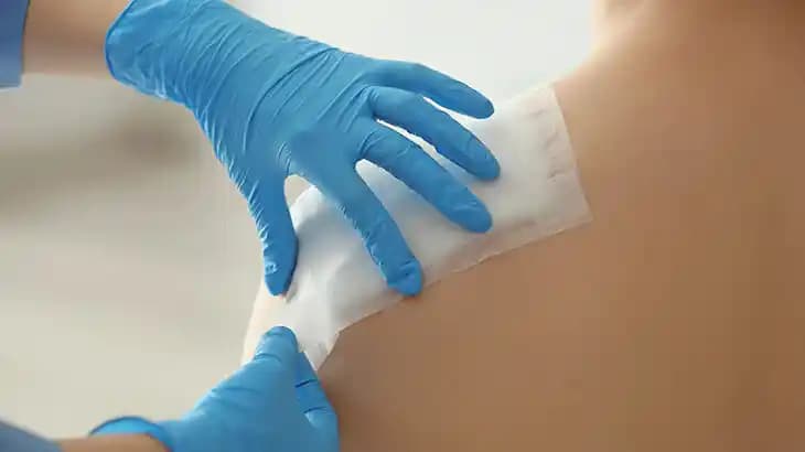 Dikişlerin Kaşınması Nedenleri ve Sağlıklı İyileşme İçin Alınması Gereken Önlemler