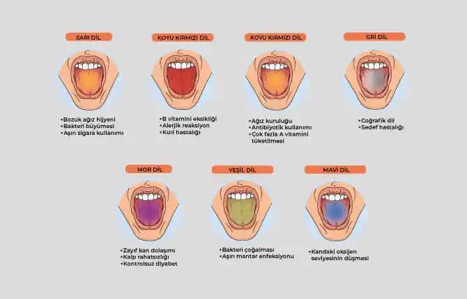 Dil Kızarıklığına Karşı Etkili Çözüm Yolları ve Kozmetik Bakım İpuçları