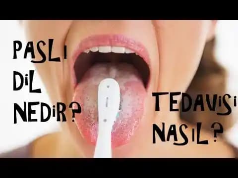 Dil Pası Tedavisi ve Kozmetik Bakımında Güncel Yaklaşımlar