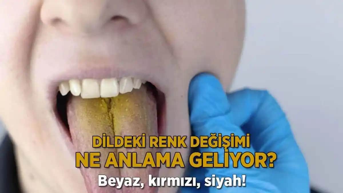Dildeki Kesiklerin Nedenleri ve Sağlık ile Kozmetik Perspektifleri