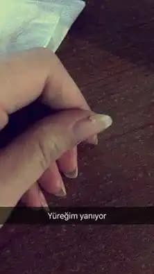 Dipten Kırılan Tırnaklar Nedenleri ve Koruma Yöntemleri Hakkında Bilgilendirici Rehber