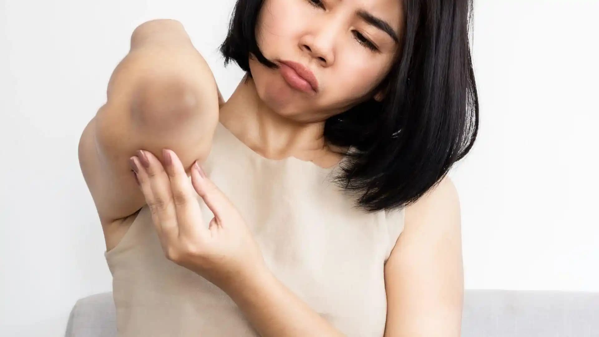 Dirseklerdeki Kararmayı Önleme ve Güzelleştirme Yöntemleri