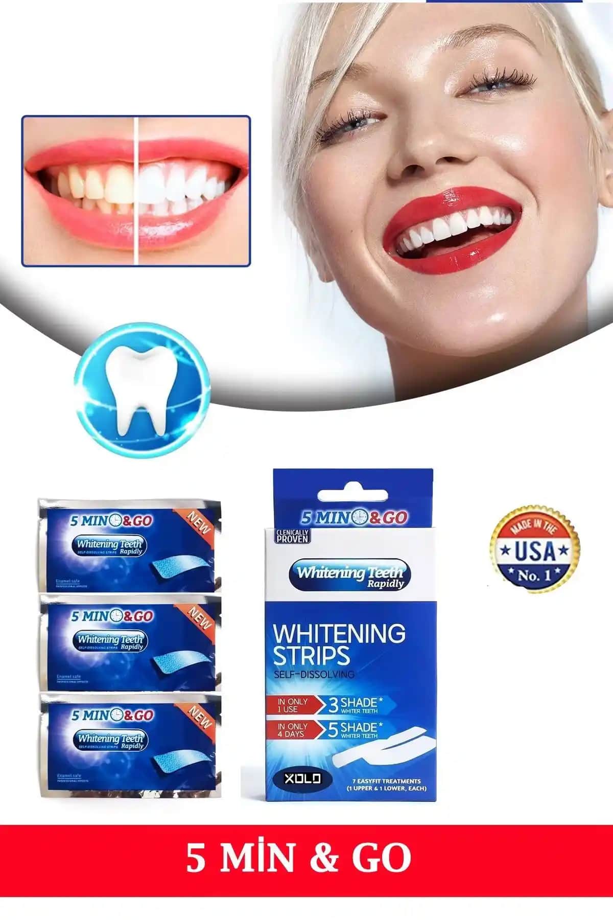 Diş Bandı Nedir ve Gülümsemeyi Güzelleştiren Kozmetik Çözüm Özellikleri