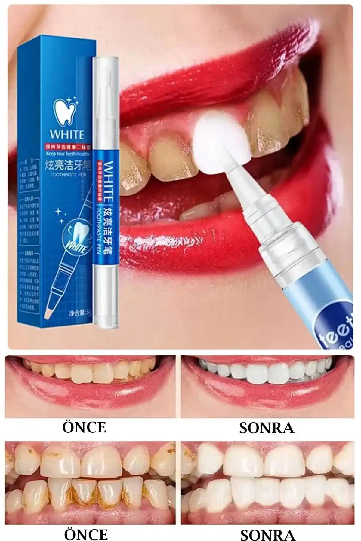 Diş Beyazlatma Jelinin Özellikleri ve Güvenli Kullanımı Hakkında Bilmeniz Gerekenler