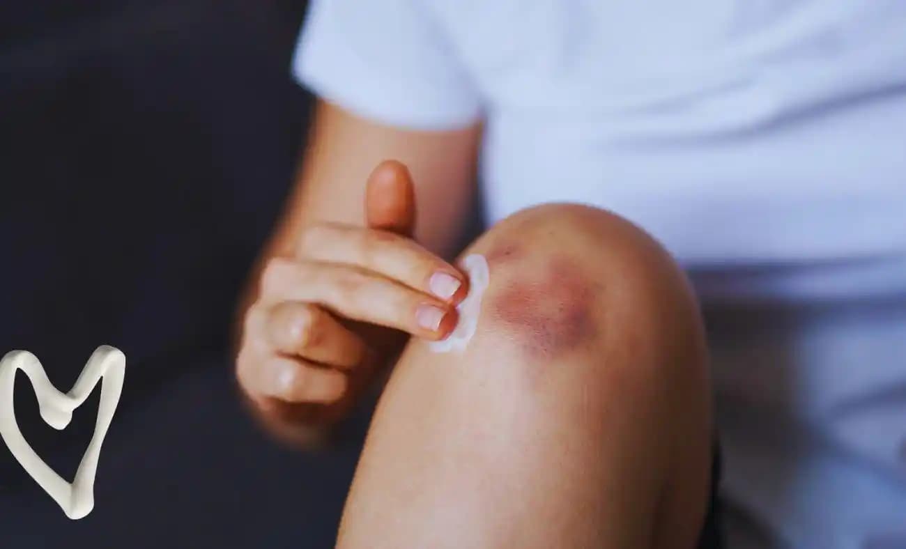 Diz Kararması Neden Olur ve Gelişmiş Kozmetik Çözüm Yöntemleri