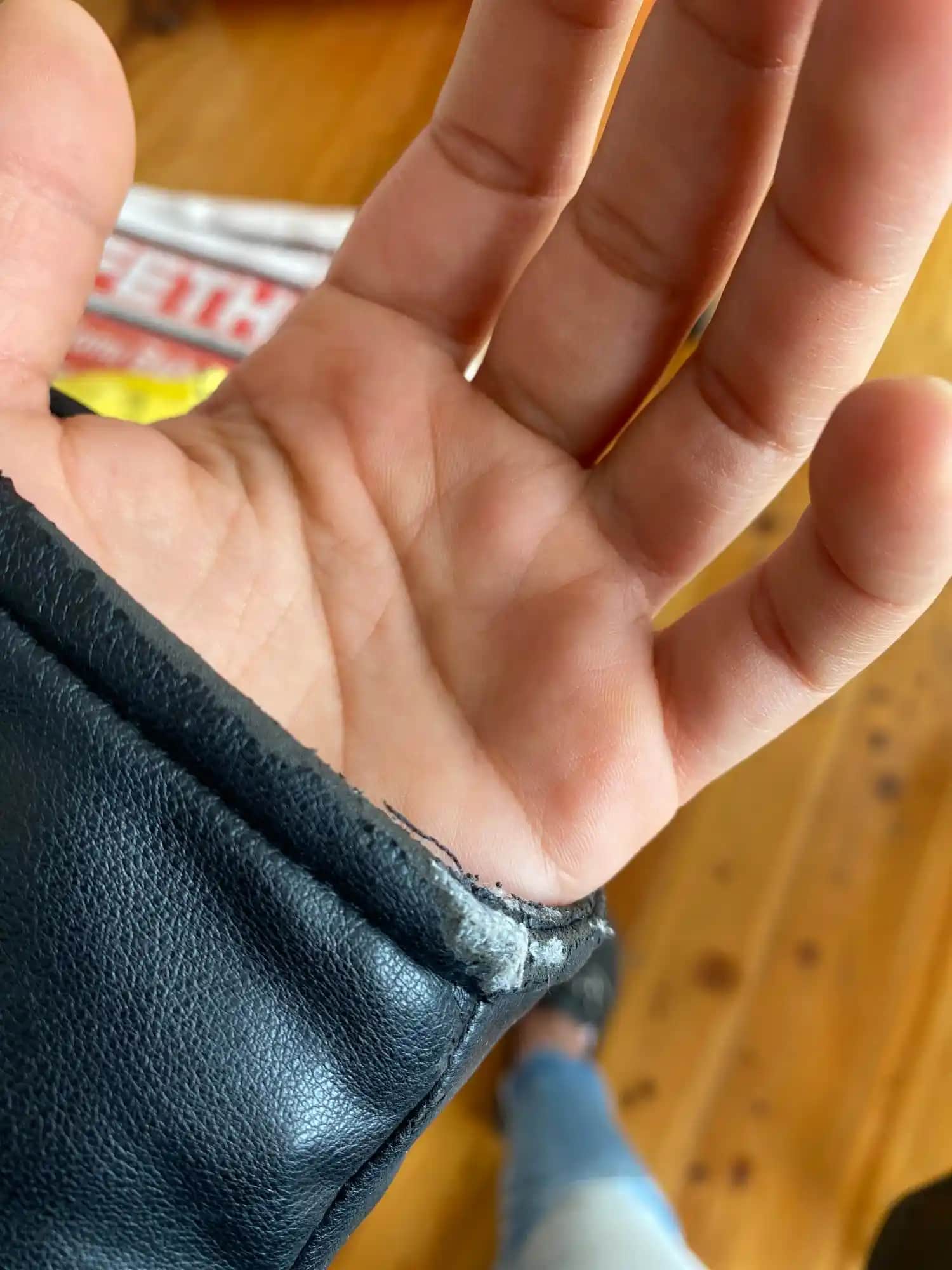 Dövme Deri Soyulması ve İyileşme Sürecinde Dikkat Edilmesi Gerekenler