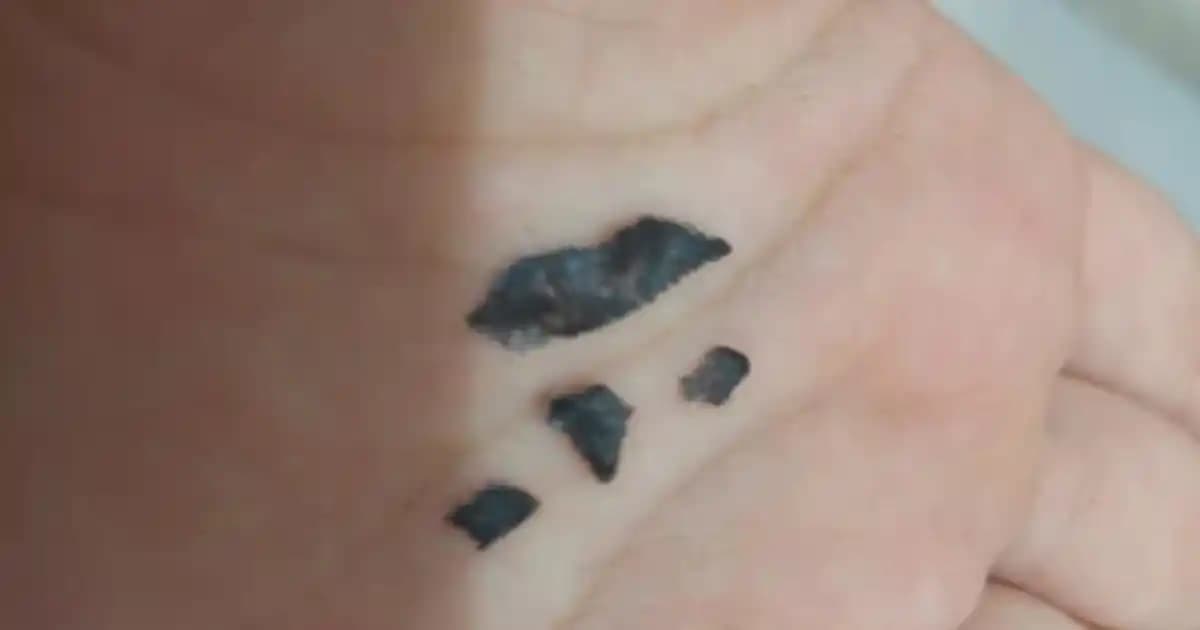 Dövme Kabuk Atma Süresi ve Sağlıklı İyileşme Rehberi