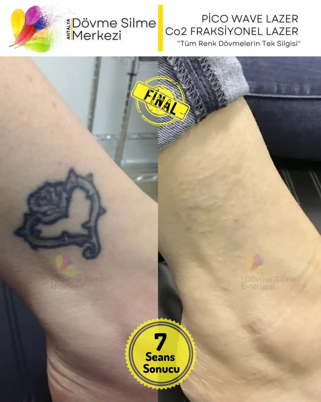 Dövme Sonrası Duş ve Bakım Rehberi: Sağlıklı ve Kalıcı Dövmeler İçin En İyi Uygulamalar