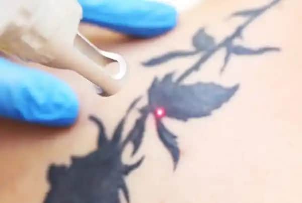 Dövme Sonrası Yıkama ve Bakım Süreci Hakkında Bilmeniz Gerekenler