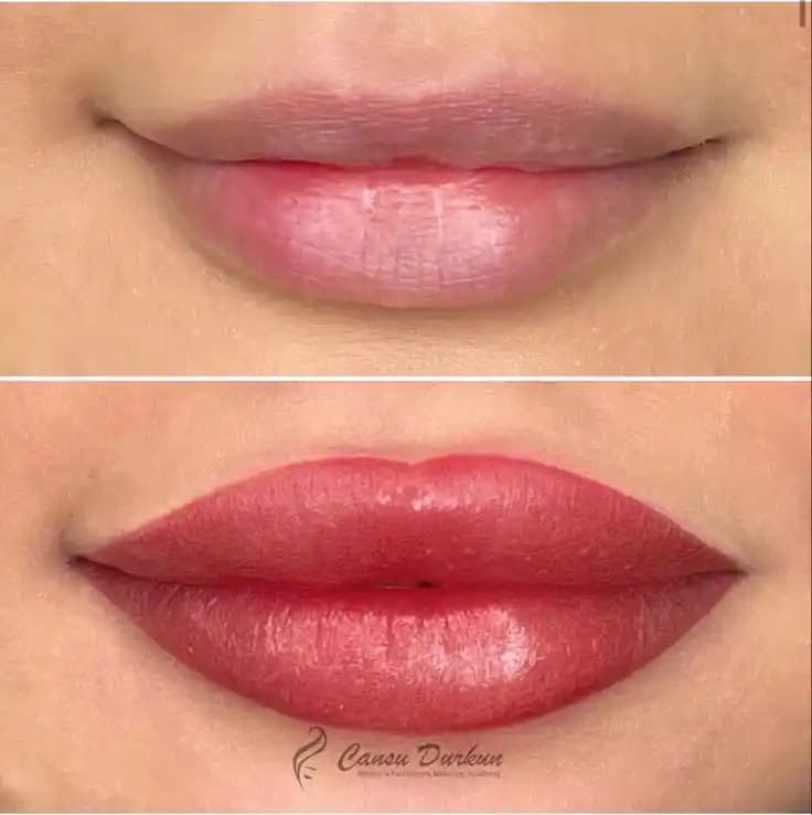 Dudak Modelleri ve Trendleri: Yüzünüz İçin En Uygun Dudak Şekli Seçenekleri