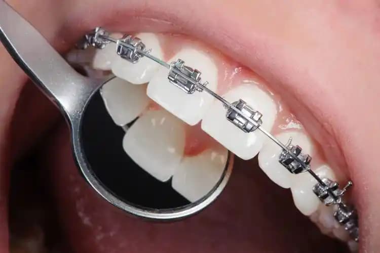 Eczanede Ped Satışı Yasal mı, Kadın Hijyeni ve Ürün Çeşitleri Hakkında Bilgiler