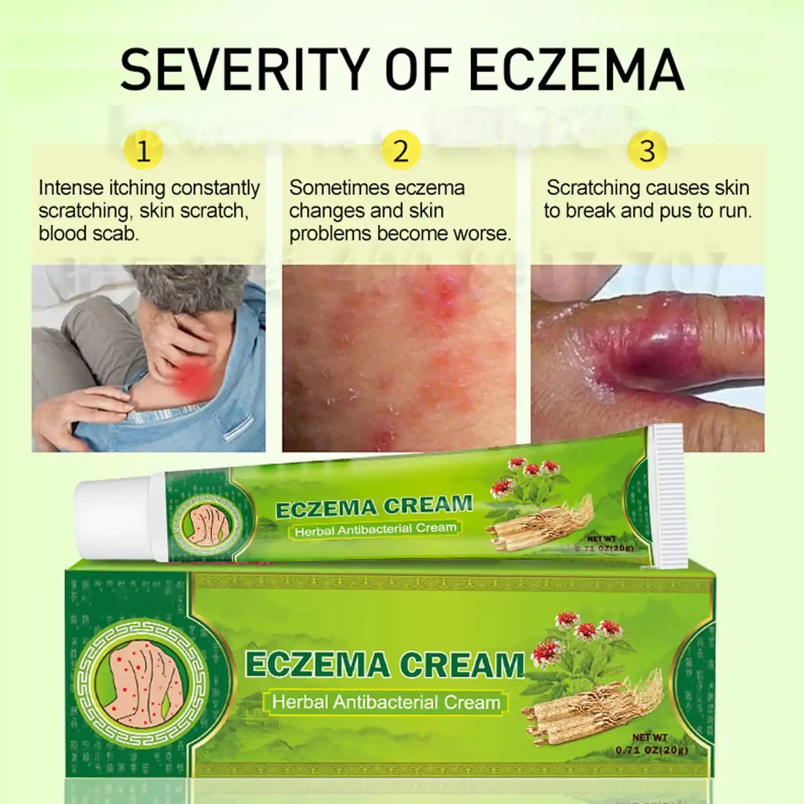 Egzama İçin Güvenilir Doğal ve Bitkisel Krem Seçenekleri Rehberi