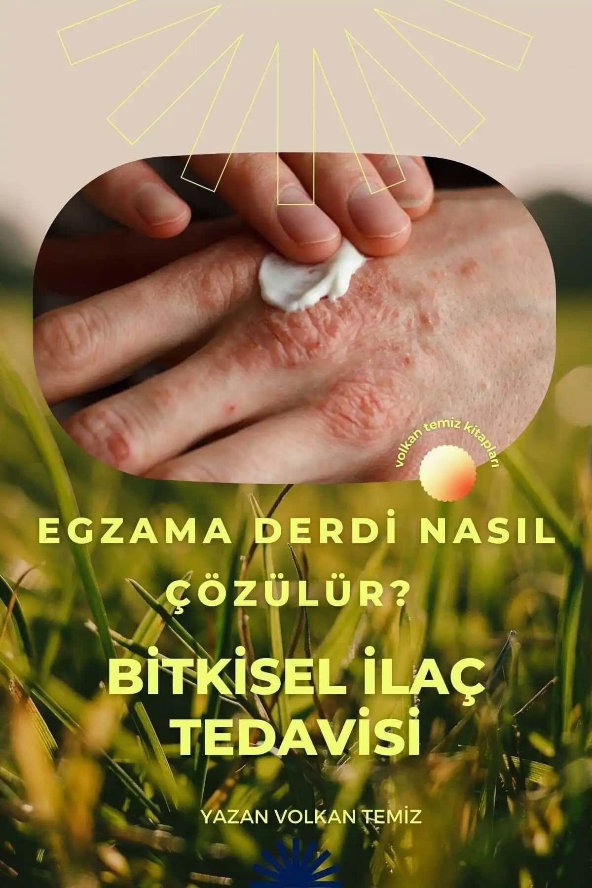 Egzama Tedavisinde İğne Yöntemi: Cilt Sağlığında Yeni Bir Yaklaşım ve Uygulama İpuçları