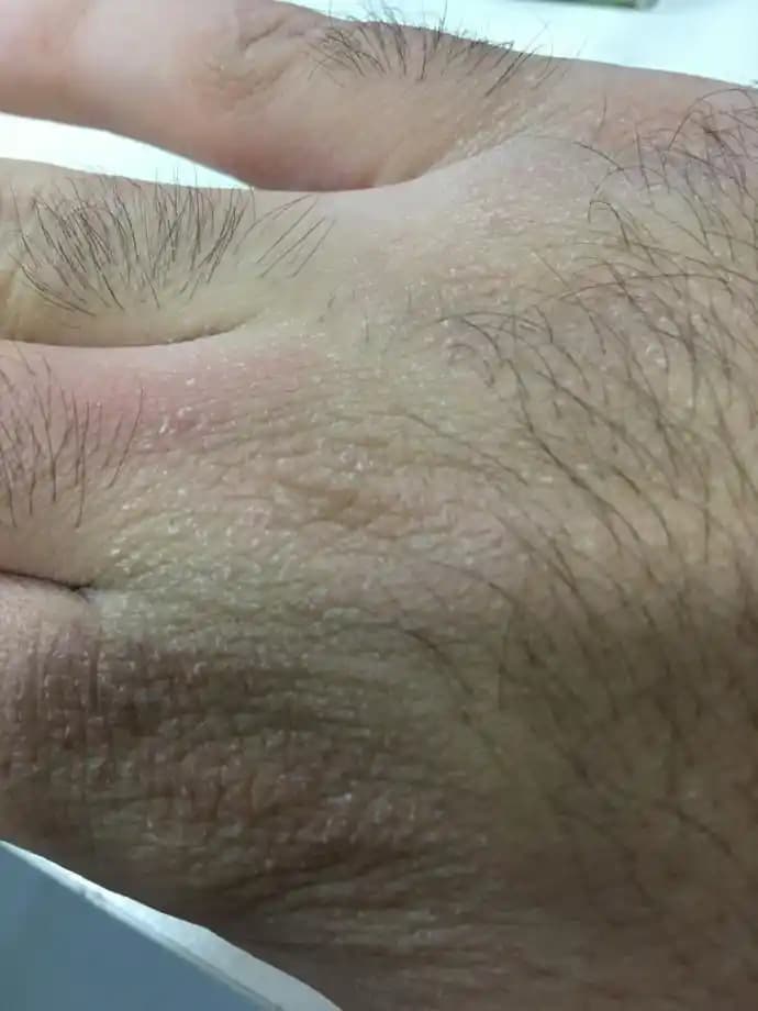 El Kuruluğu Nedenleri ve Etkili Bakım Yöntemleri Kozmetik Çözümlerle Nasıl Giderilir