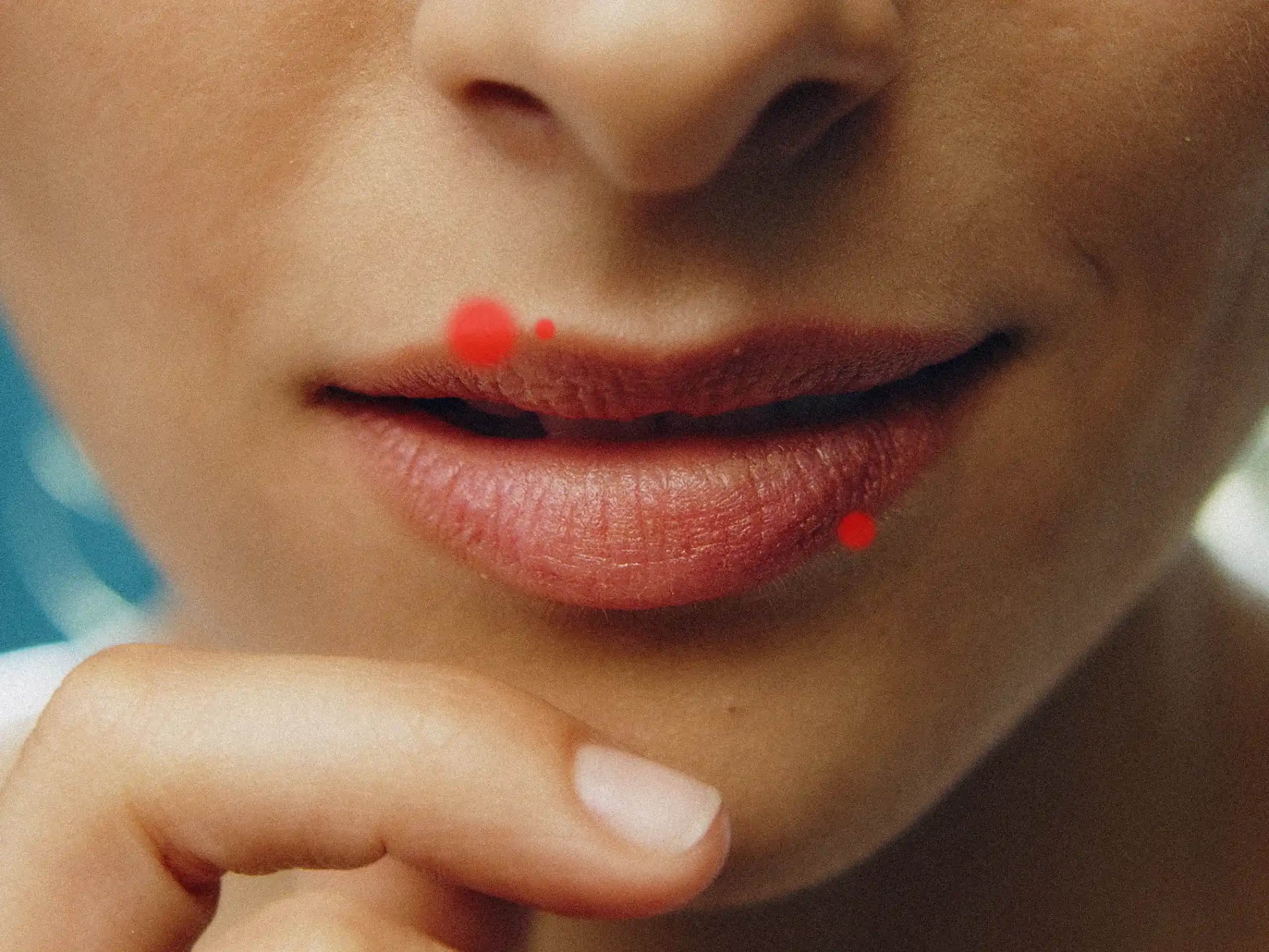 El Üstünde Sivilce Çıkmasının Nedenleri, Etkileri ve Çözüm Yolları