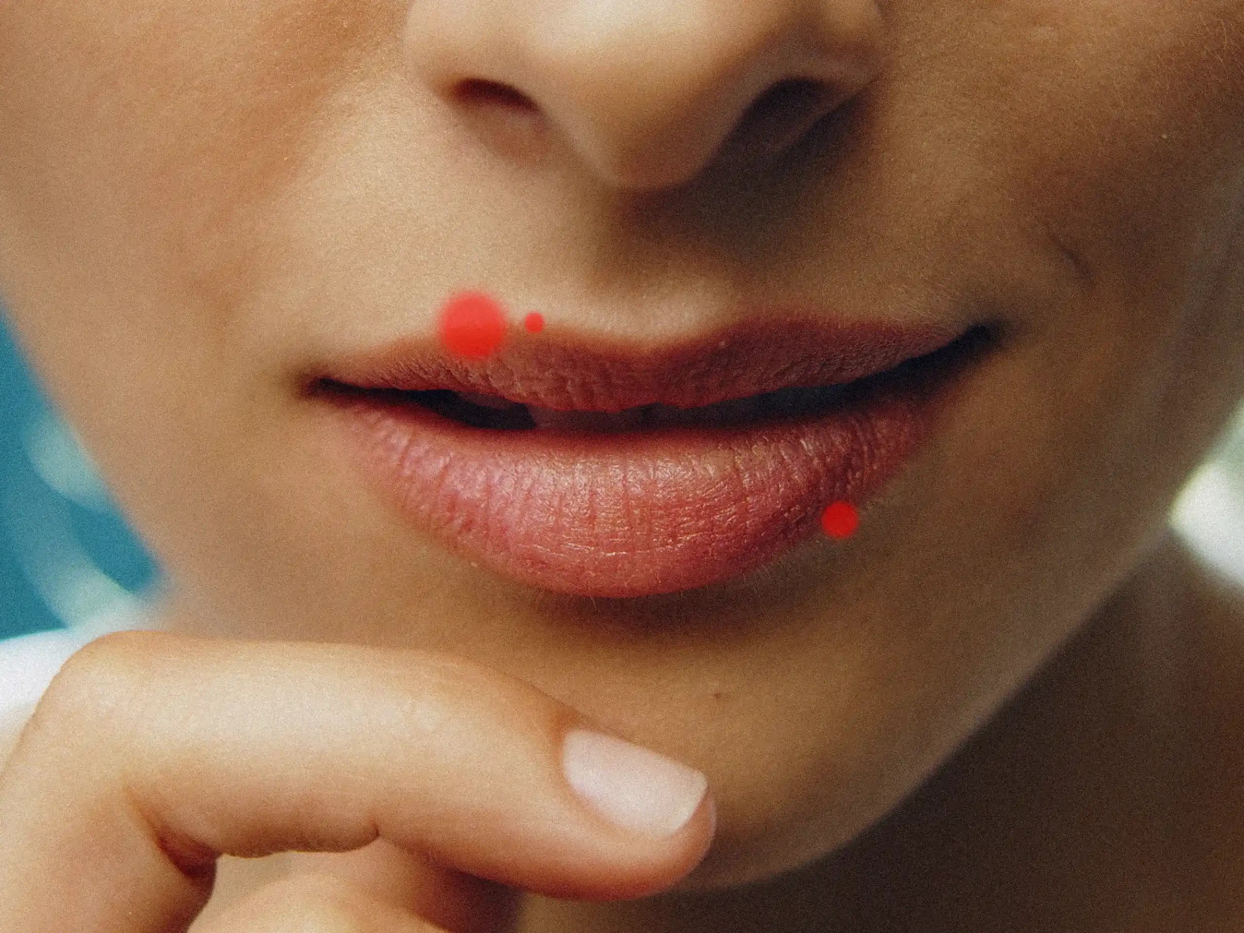 El Üstünde Sivilce Çıkmasının Nedenleri, Etkileri ve Çözüm Yolları