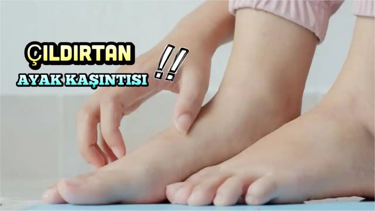 El ve ayak kaşıntısına doğal ve kozmetik çözümler: etkili bakım ve tedavi yöntemleri