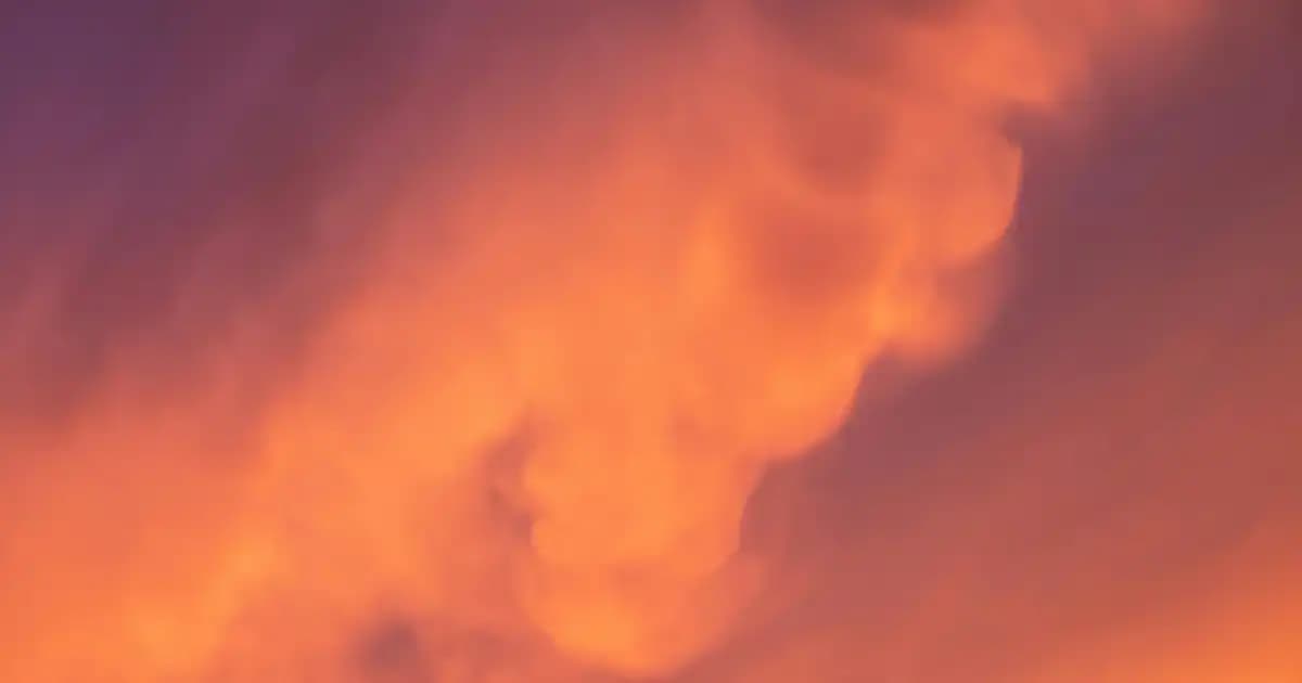 Ellerde Egzama Nedenleri Belirtileri ve Doğal Çözüm Yöntemleri Hakkında Kapsamlı Bilgi