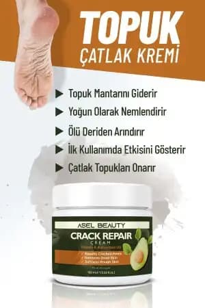 En Etkili Ayak Mantar Kremleri ve Doğal Çözümlerle Sağlıklı Ayaklar