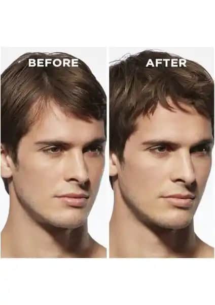 Erkekler İçin Saç Kalınlaştırıcı Ürünler: Güçlü ve Dolgun Saçlar İçin Kapsamlı Rehber