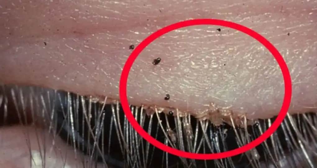 Erkeklerde Kasık Piti: Kozmetik Yaklaşımlarla Sağlıklı ve Güzel Görünüm Rehberi