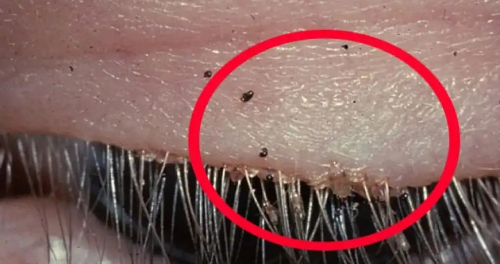 Erkeklerde Kasık Piti: Kozmetik Yaklaşımlarla Sağlıklı ve Güzel Görünüm Rehberi