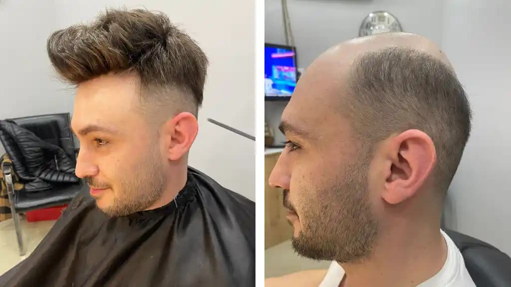 Erkeklerde Saç Canlandırma Yöntemleri ve Güncel Trendler Hakkında Kapsamlı Bilgi