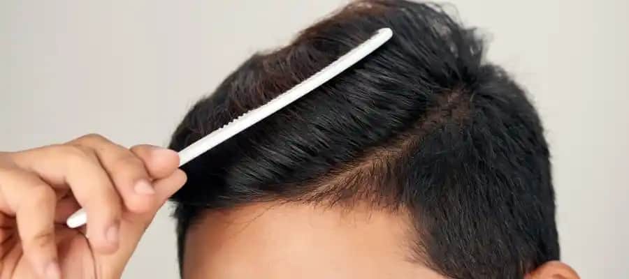 Erkeklerde Saç Yağlanmasının Nedenleri ve Etkili Çözüm Yolları Hakkında Kapsamlı Rehber