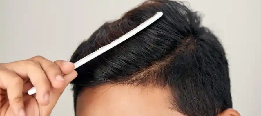 Erkeklerde Saç Yağlanmasının Nedenleri ve Etkili Çözüm Yolları Hakkında Kapsamlı Rehber