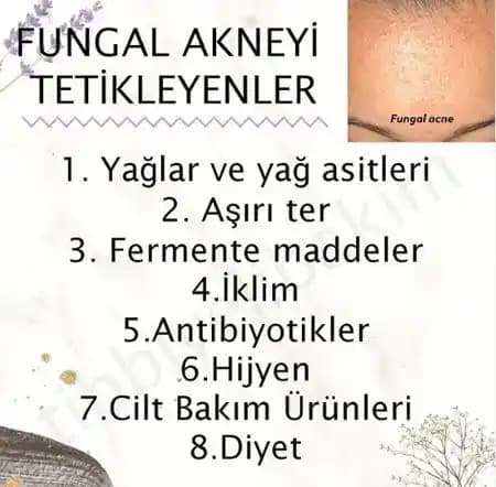 Fungal Akne Nedir, Belirtileri ve Güncel Tedavi Yöntemleri Hakkında Kapsamlı Bilgi