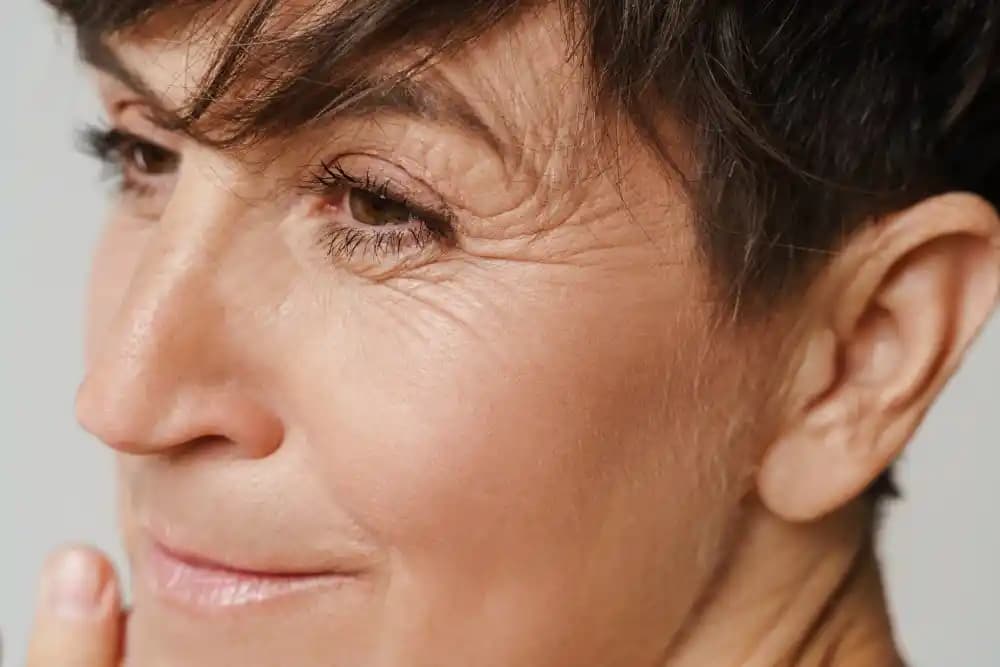 Genç Yaşta Göz Çevresi Kırışıklıklarının Nedenleri ve Korunma Yöntemleri