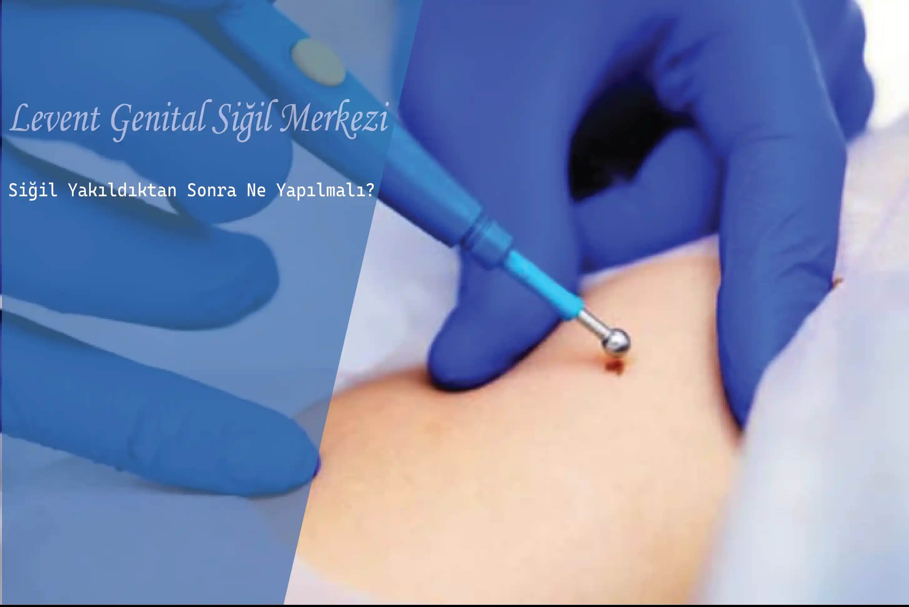 Genital Bölge Kararması Nedenleri ve Etkili Çözüm Yöntemleri Hakkında Detaylı Rehber