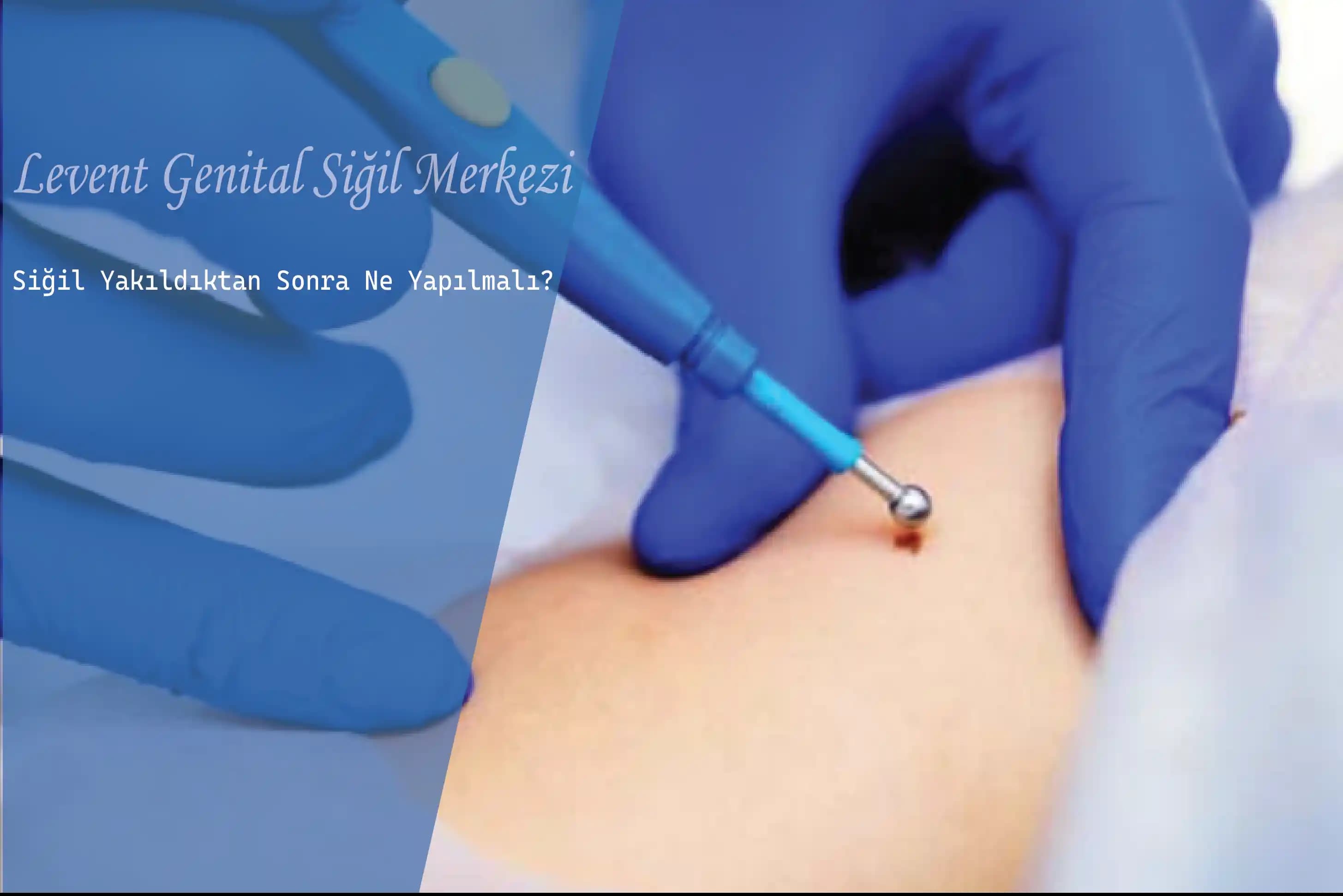 Genital Bölge Kararması Nedenleri ve Etkili Çözüm Yöntemleri Hakkında Detaylı Rehber