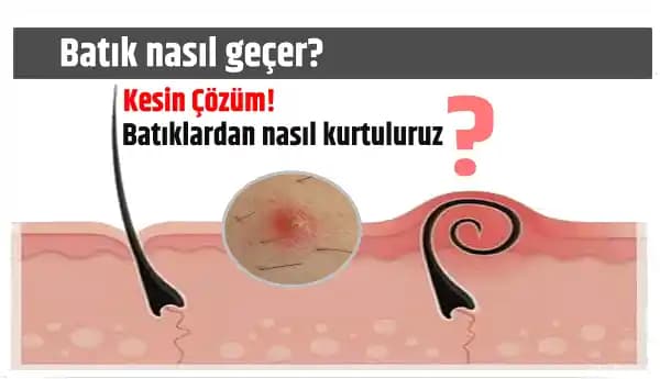 Genital Bölgedeki Batık İzleriyle Etkili Mücadele Yöntemleri ve Doğru Bakım İpuçları