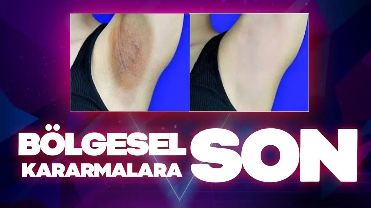 Genital Bölgedeki Kararma Sorunu ve Etkili Çözüm Yolları Analizi