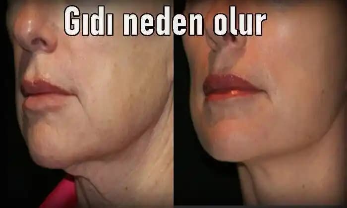 Gıdı Neden Oluşur? Etkileyen Faktörler ve Alınabilecek Önlemler