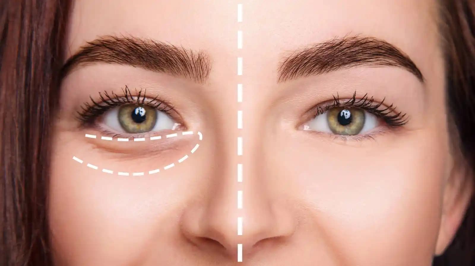 Göz Altı Bakımında Etkili Yöntemler ve Doğru Ürün Seçimi Rehberi