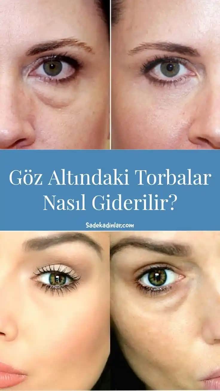 Göz Altı Kabuklanması Nedenleri Belirtileri ve Etkili Çözüm Yöntemleri