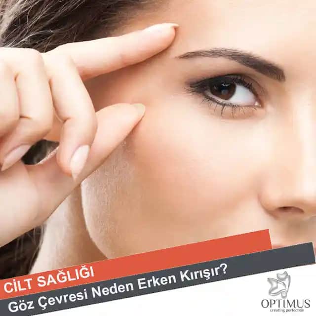 Göz Altı Kırışıklıklarının Nedenleri ve Gözlemlenebilir Belirtiler Üzerine Detaylı İnceleme